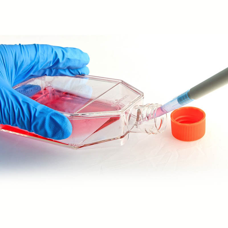 Plastic cell culture flasks molding